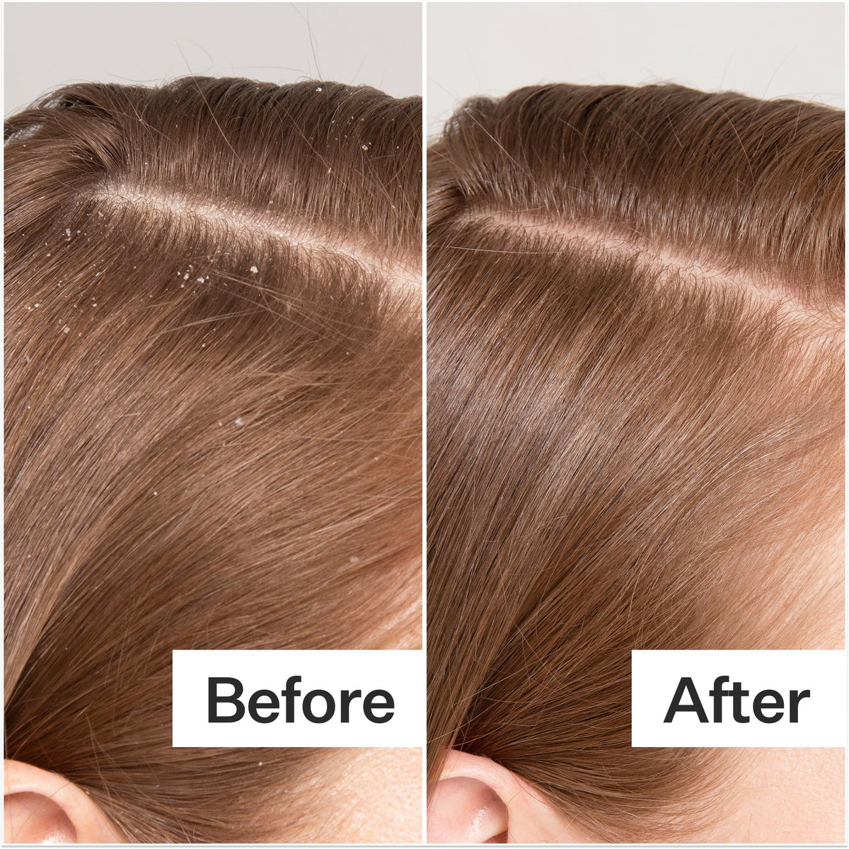 Award Winning Scalp Detox Treatment Act+Acre