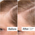 Before/After of hair growth when using Act+Acre Thick + Full Capsules