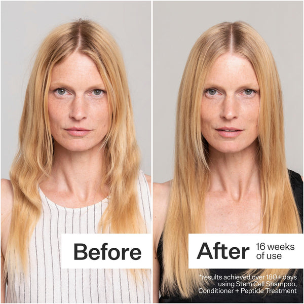 Before/After of woman with long, blonde hair using Act+Acre Stem Cell Shampoo
