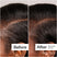 Before/After of hair growth when using Act+Acre 3% Stem Cell Peptide Treatment