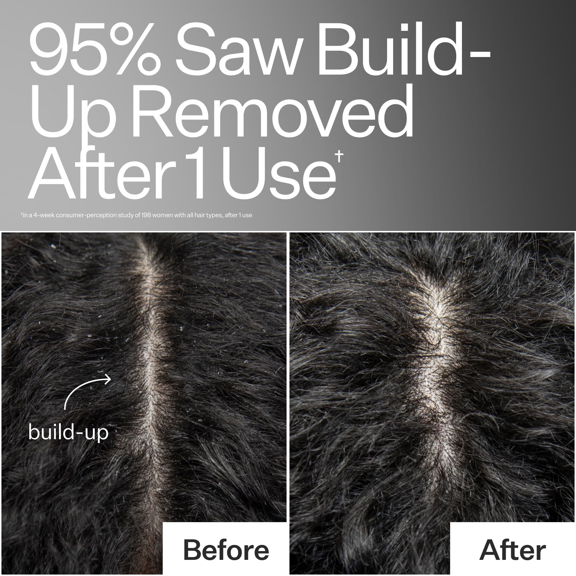 Award Winning Scalp Detox Treatment | Act+Acre