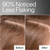 Before/After of scalp when using Act+Acre Vitamin E Scalp Detox Oil