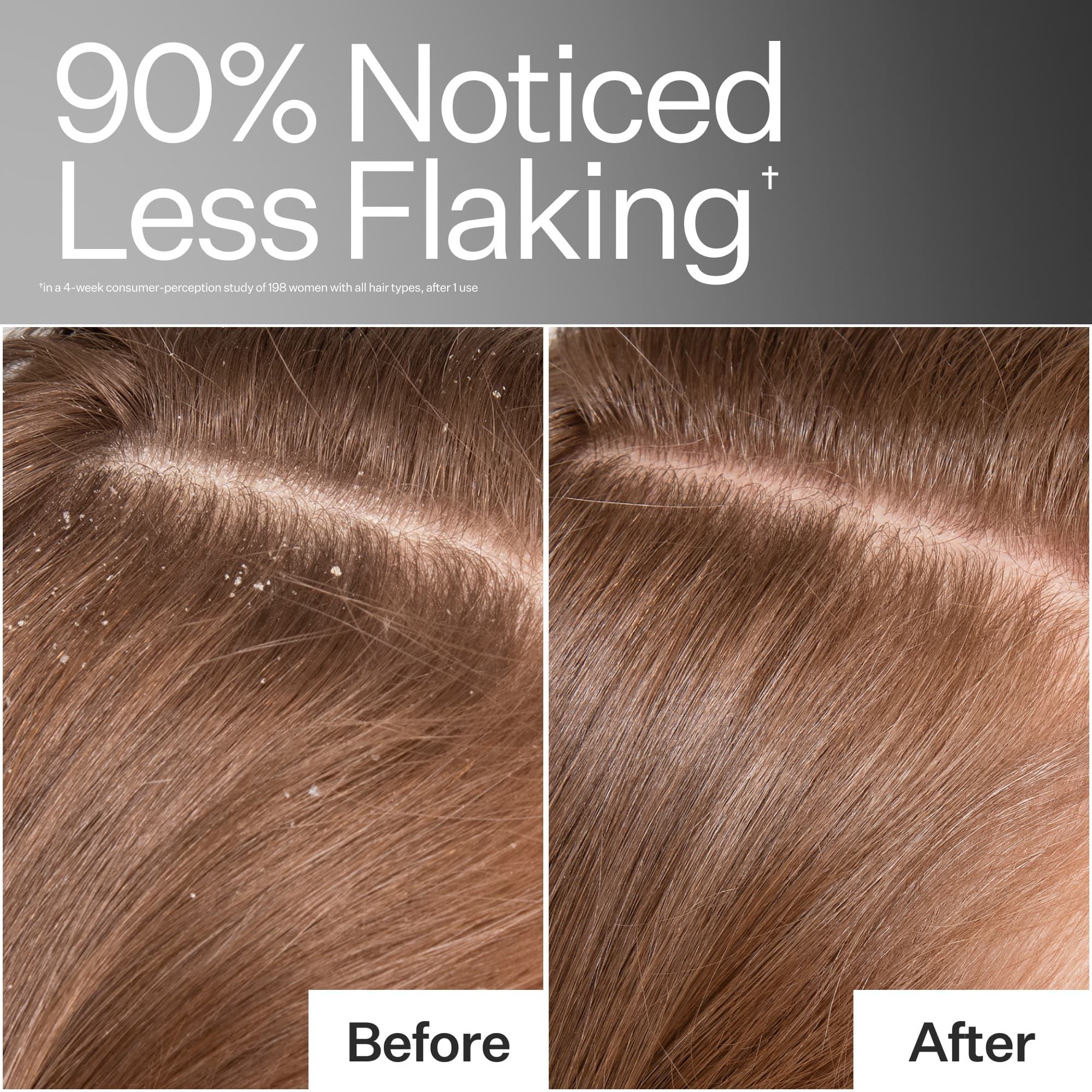 Before/After of scalp when using Act+Acre Vitamin E Scalp Detox Oil