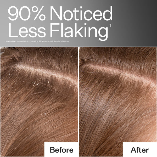 Before/After of scalp when using Act+Acre Vitamin E Scalp Detox Oil