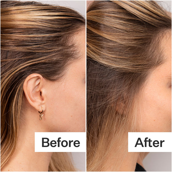 Before/After of scalp and hair after using Act+Acre Fulvic Acid Volumizing Dry Shampoo