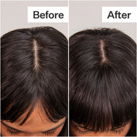 Before/After of scalp and hair after using Act+Acre Fulvic Acid Volumizing Dry Shampoo