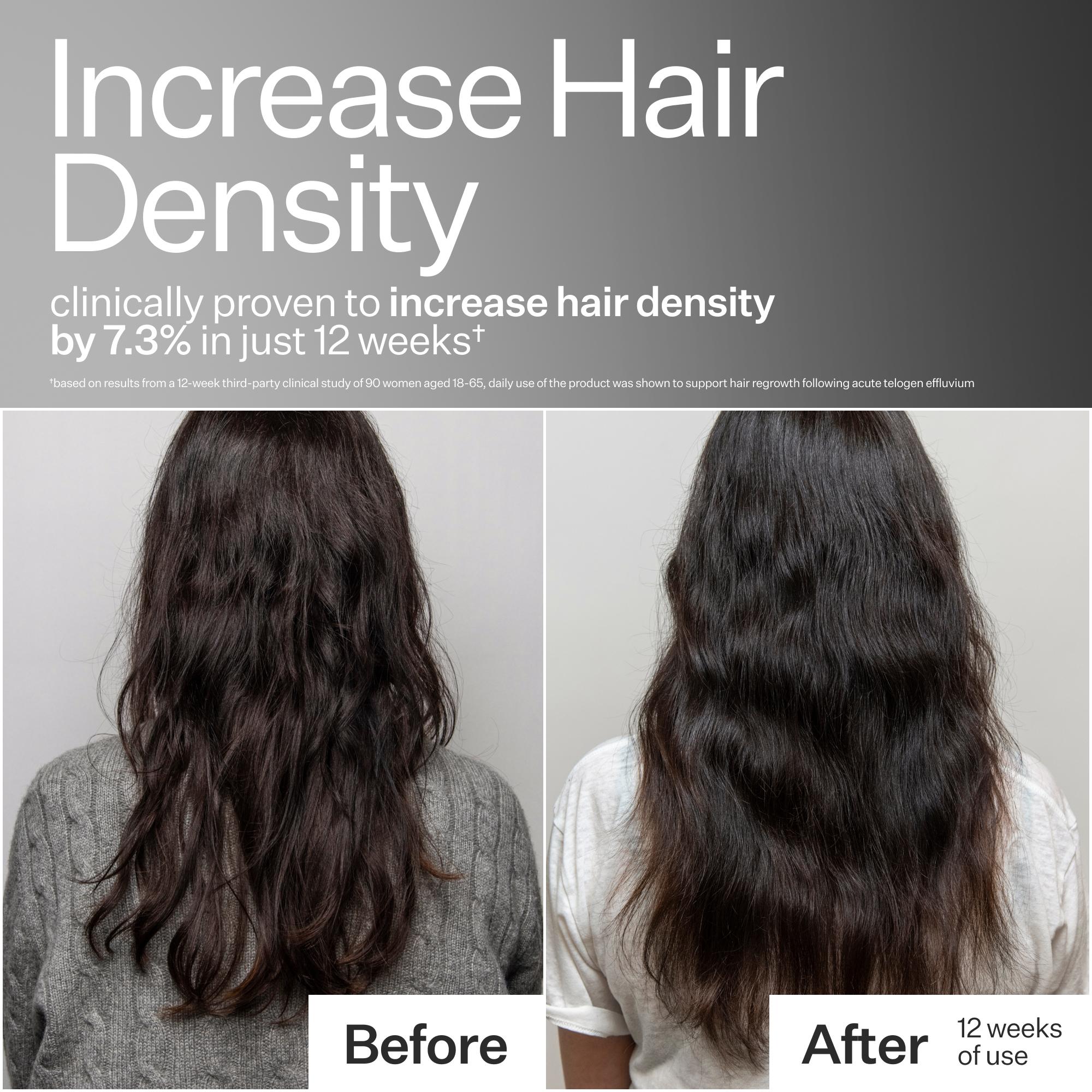Before and after comparison of hair density increase with text claiming clinical proven results.