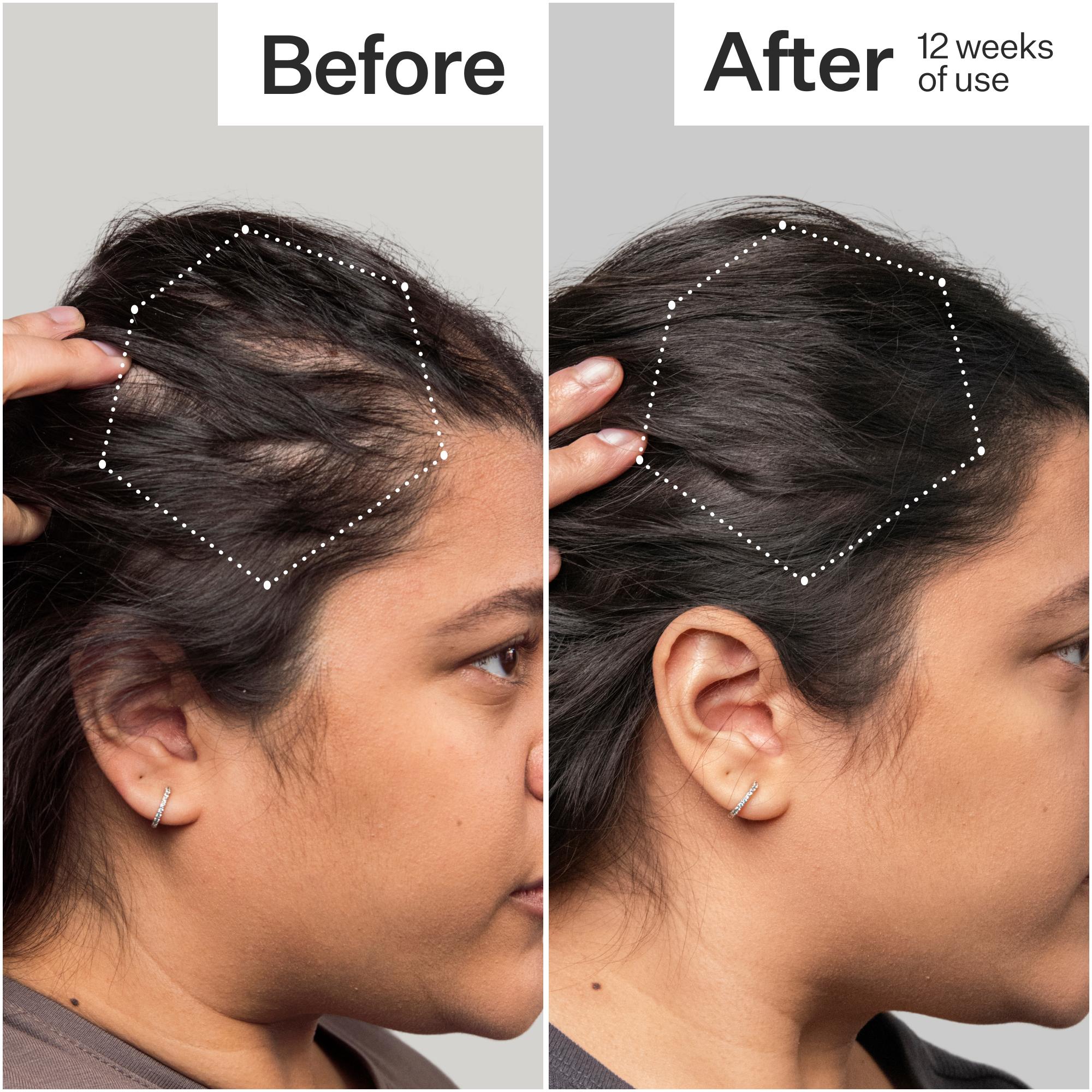 3% Stem Cell Peptide Treatment – Act+Acre