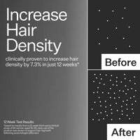 Infographic for hair density increase with 'Before' and 'After' comparison on a gray background.