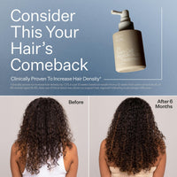 Hair treatment product with 'Before' and 'After' results showing increased hair density.