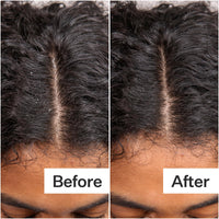 Before and after comparison of hair growth on a person's head.