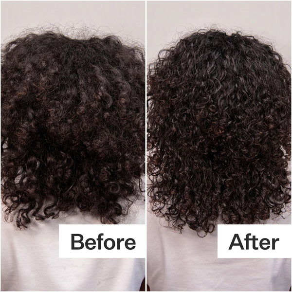 Before/After when using Daily Hydro™ Scalp Serum