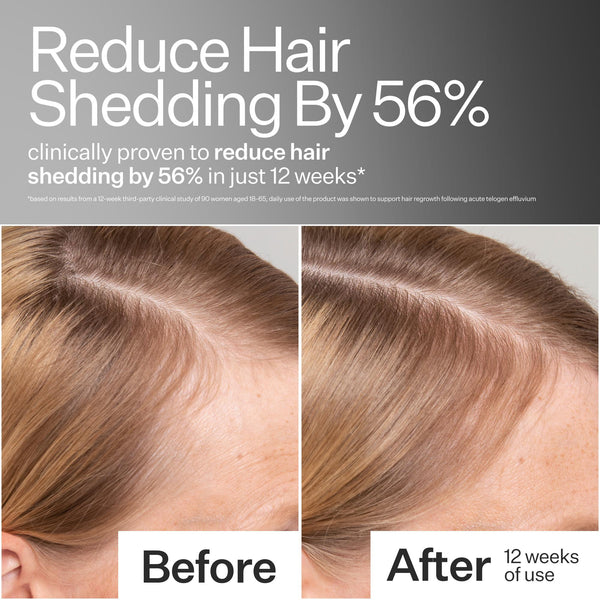 Before/After of reduced hair shedding when using Act+Acre Advanced Fuller Hair System