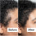 Before/After of hair growth when using Act+Acre Dermaroller Hair System