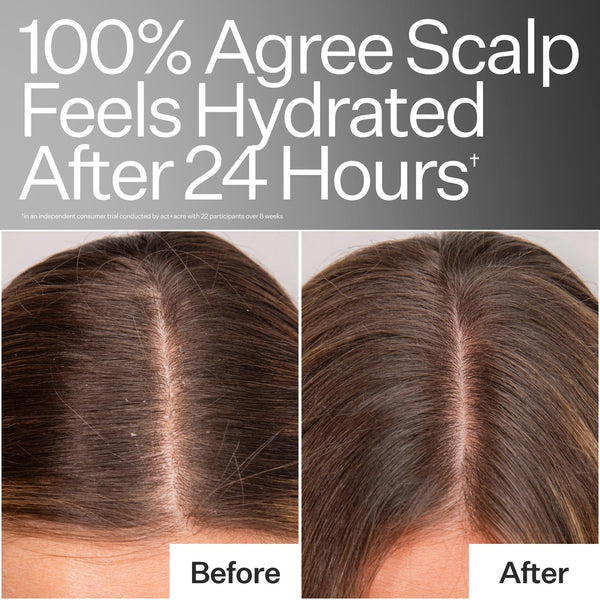 Results from consumer study, before and after images of model hairline close up 