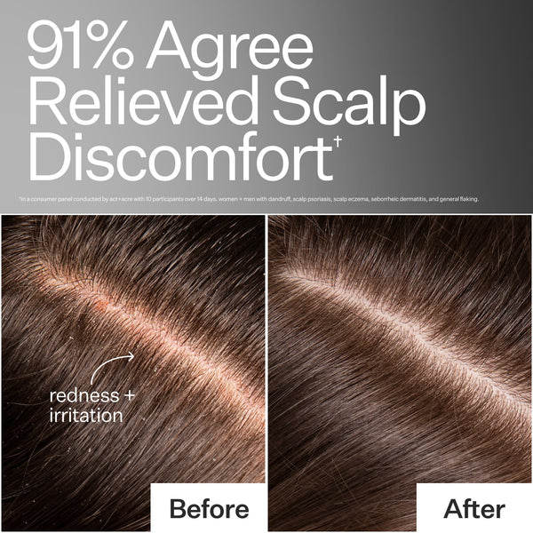 Results from consumer perception study, before and afters of model hair line 