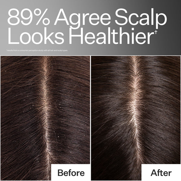 Results from a consumer perception study, Before and After photos of models hairline 