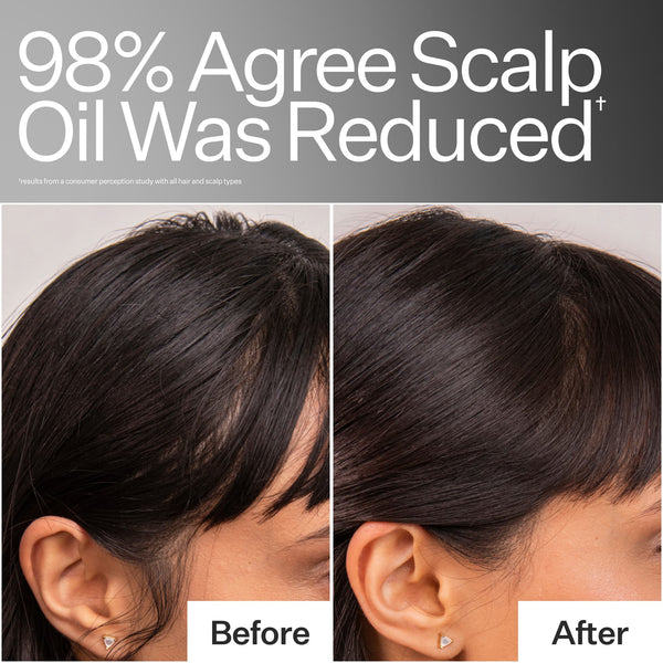 Results from a consumer perception study on oil reduction, Before and After pictures of side of models hairline 