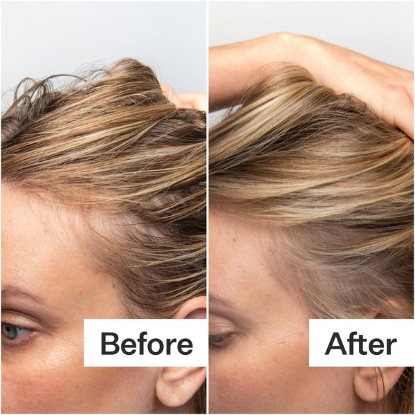Before/After of scalp + hair when using Act+Acre Oily Scalp System