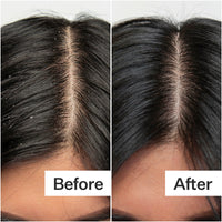 Before/After of scalp when using Act+ Acre BHA Salicylic Acid Scalp Exfoliator