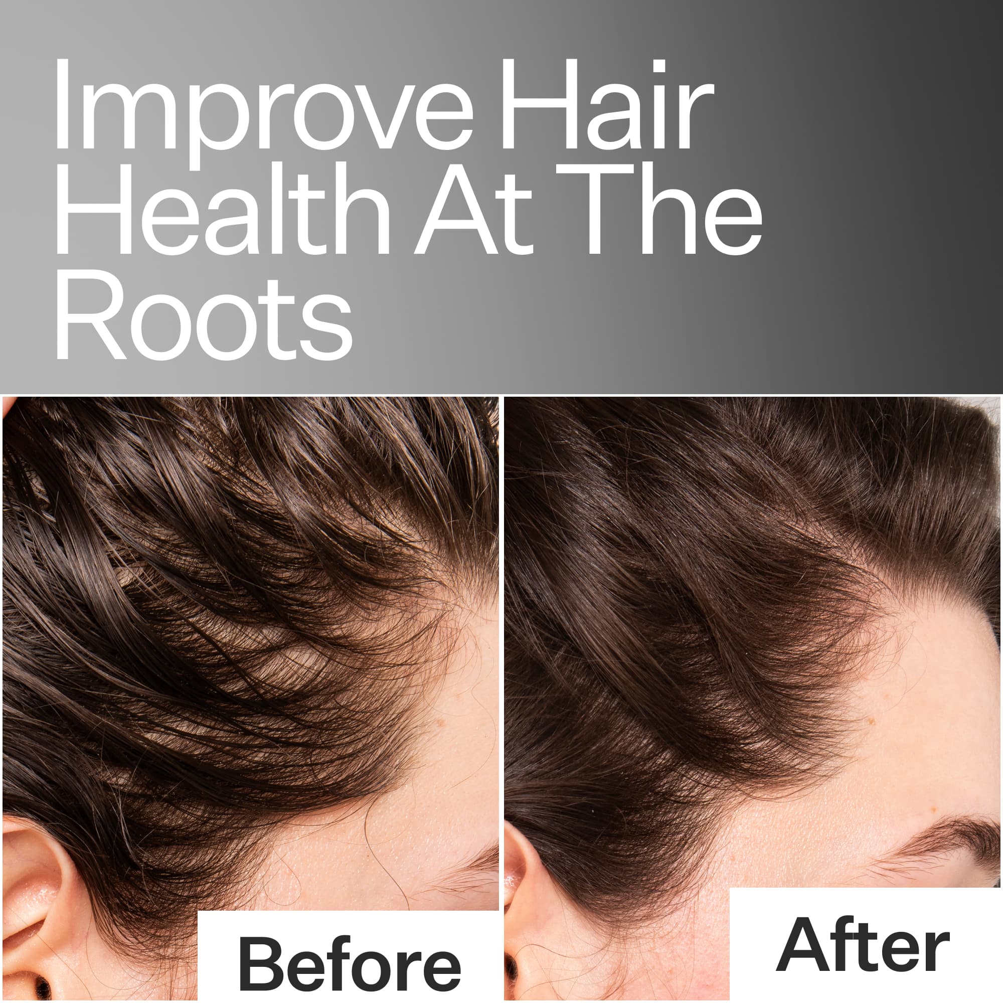 Before/After of improved hair health when using Act+Acre Scalp Relief System