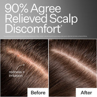 Before/After of improved hair health when using Act+Acre Scalp Relief System