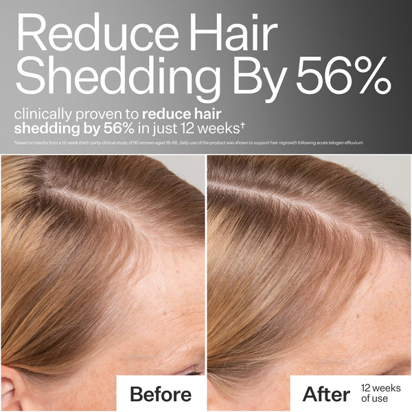 Results from a consumer study, before and after images close up of models hairline 